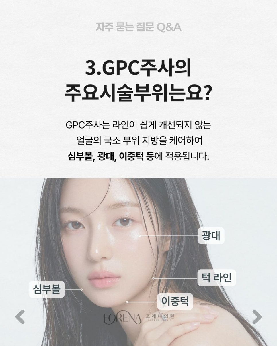GPC얼굴지방용해주사 Q&A | 시술 원리와 특징 정리 관련 이미지 4