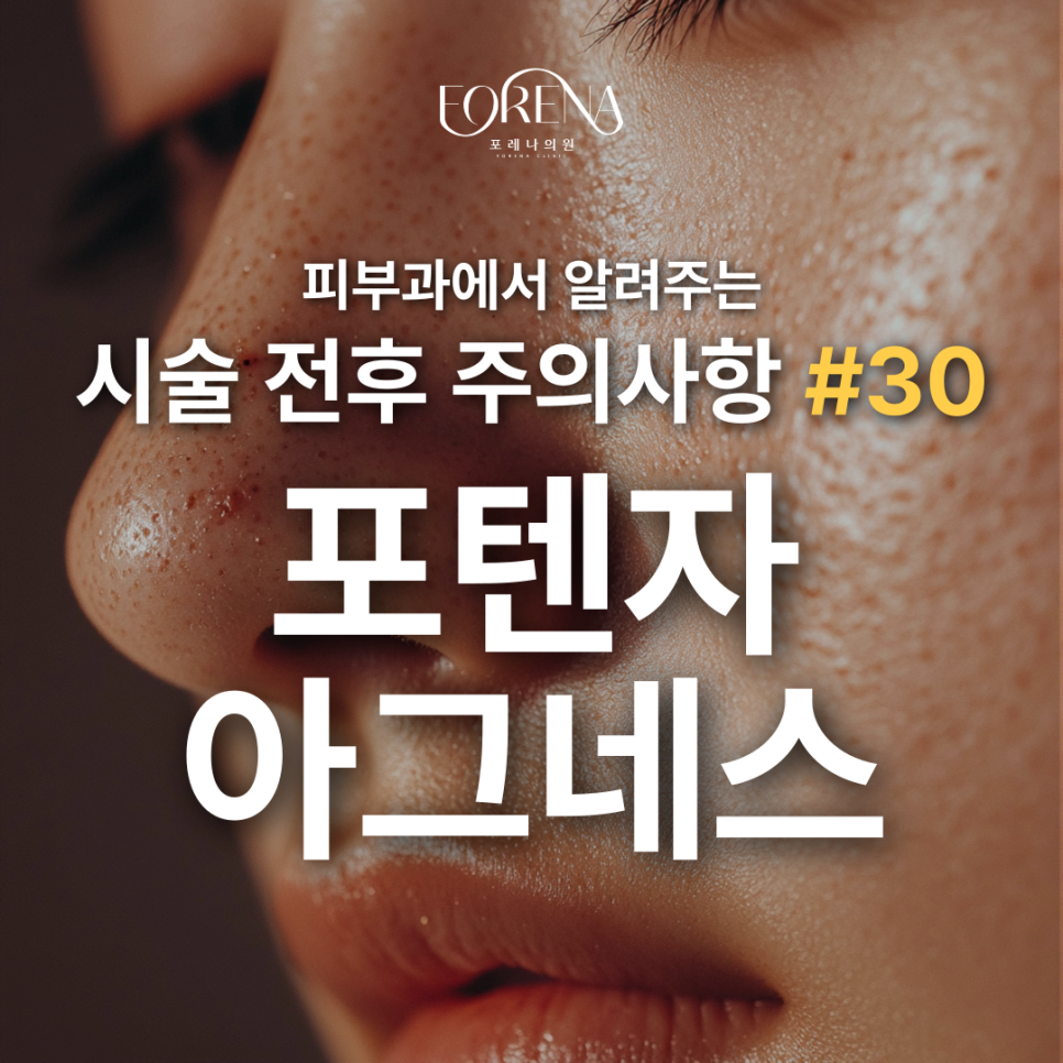 포텐자 아그네스 주의사항 홍대 피부과 포레나의원 에서 알려드립니다. 관련 이미지 2