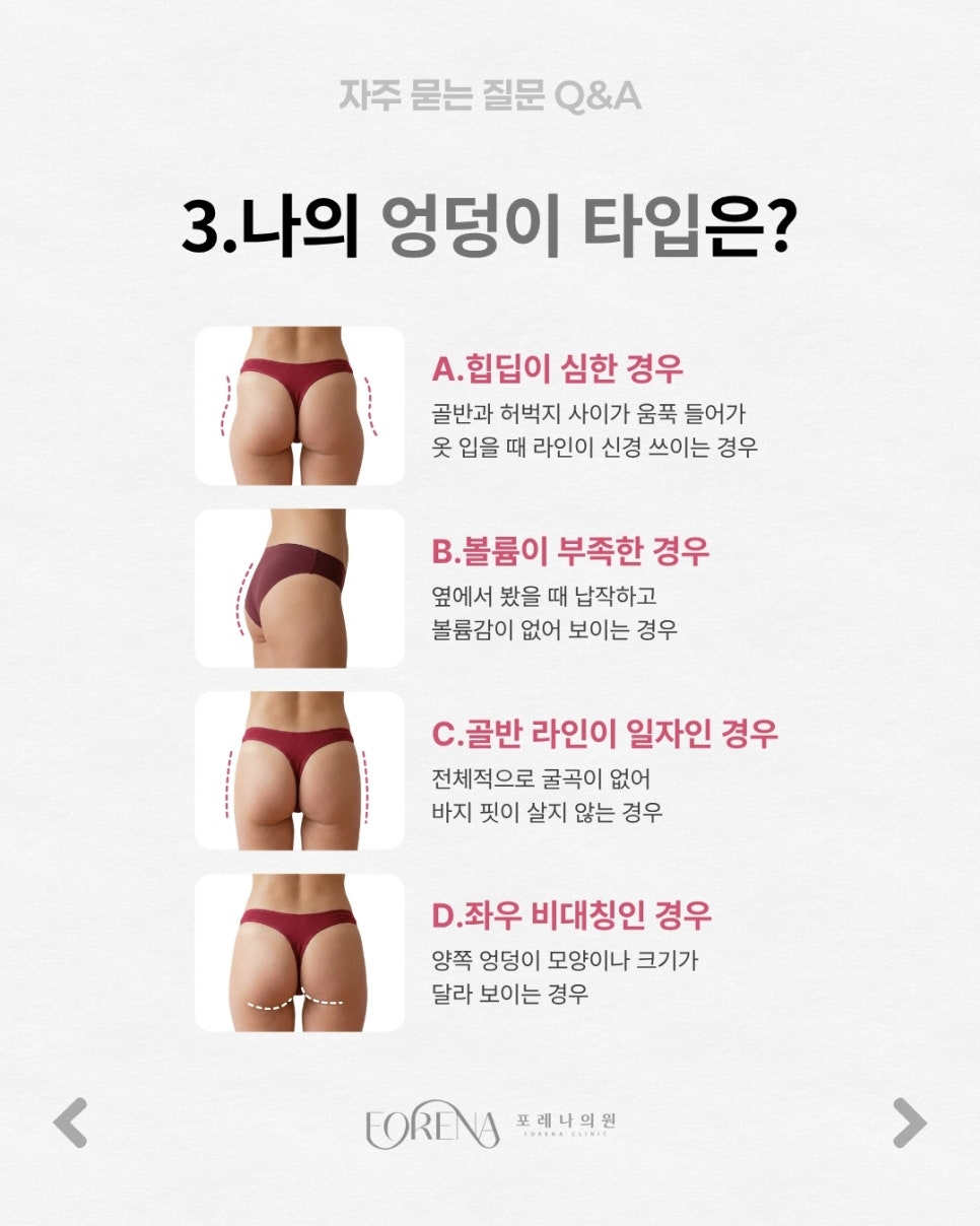 골반(엉덩이)필러 Q&A | 시술 원리와 특징 정리 관련 이미지 4
