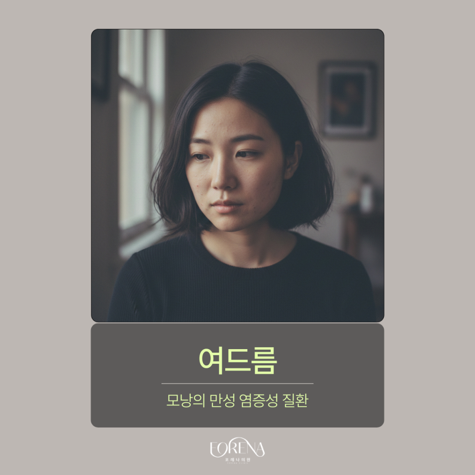 여드름 잘 생기는 부위는 따로 있다? 관련 이미지 3