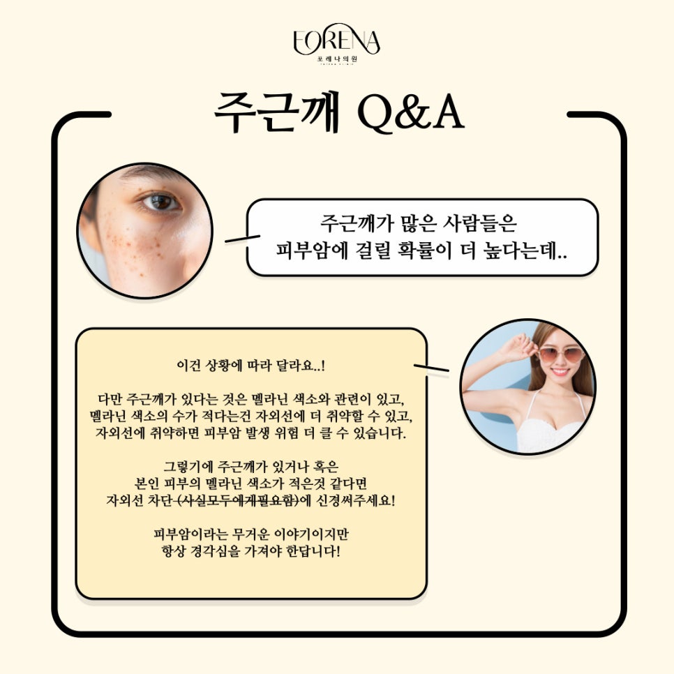 주근깨는 매력적이다? 주근깨에 대하여 자세히 알아보자! 관련 이미지 7