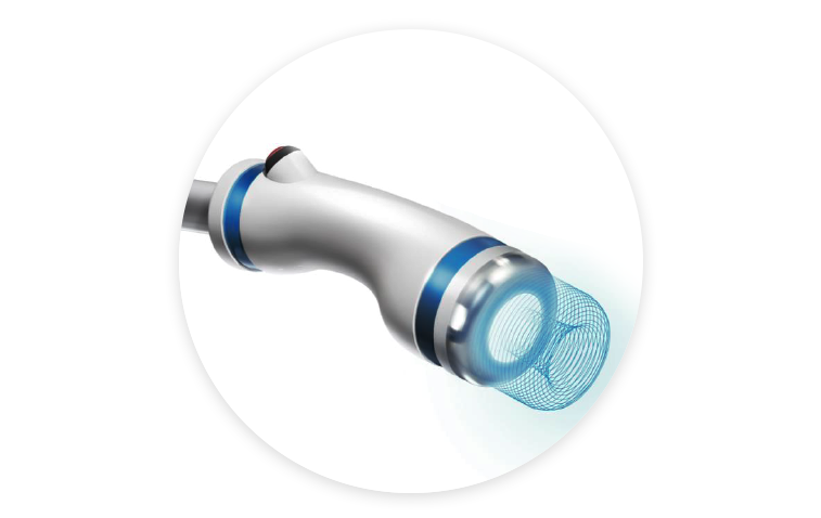 온다리프팅 Q&A | 시술 원리와 특징 정리 관련 이미지 2