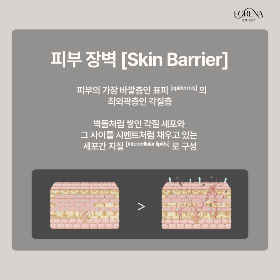 Your Skin Barrier Is Breaking Down?! image 3