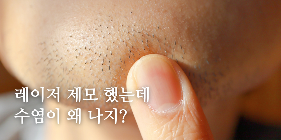 남성 레이저 제모 이거 모르고 가시면 안됩니다!🪒  홍대 포레나의원 영상으로 같이보자! 관련 이미지 3