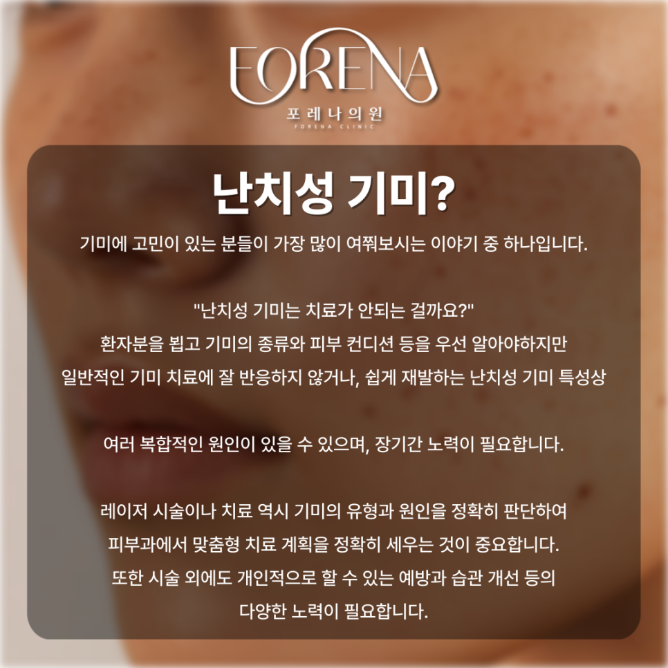 표피형, 진피형, 혼합형, 난치성 기미 고민 나한테 있는 기미는 어떤 종류일까?💧 관련 이미지 10