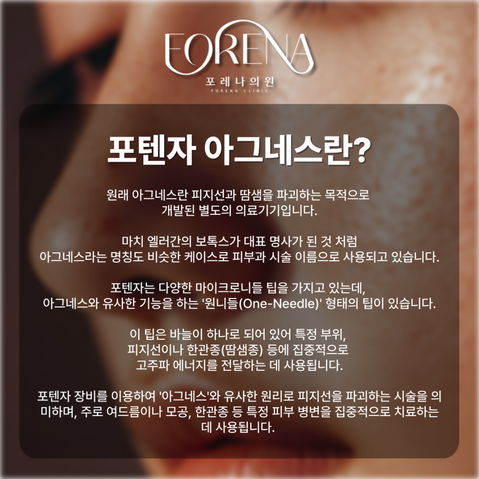 포텐자 아그네스 주의사항 홍대 피부과 포레나의원 에서 알려드립니다. 관련 이미지 3