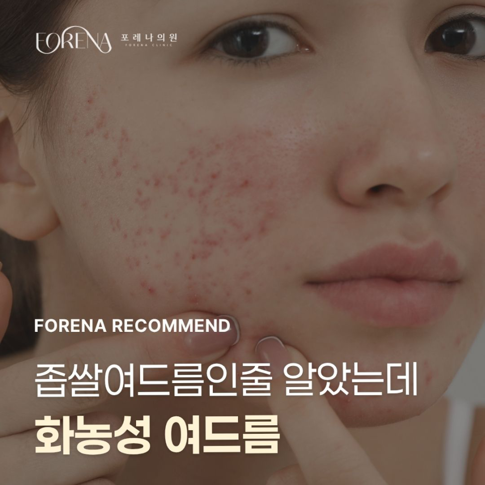 좁쌀인줄 알았는데 관련 이미지 1
