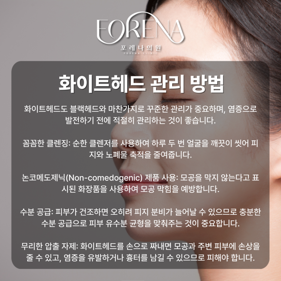 화이트헤드가 대체 뭐야? 블랙헤드랑 비슷한건가? 화이트헤드 설명해드립니다. 관련 이미지 5