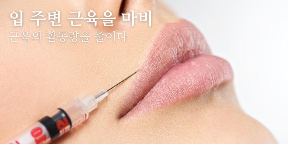 무표정인데 화나보이는 처진 입꼬리 컴플렉스? 🥹  홍대 포레나의원 영상으로 같이보자! 관련 이미지 2