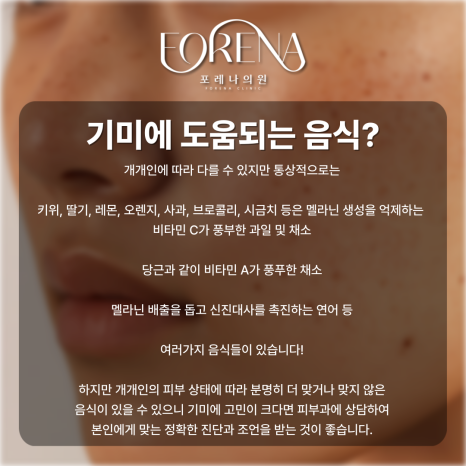 표피형, 진피형, 혼합형, 난치성 기미 고민 나한테 있는 기미는 어떤 종류일까?💧 관련 이미지 9