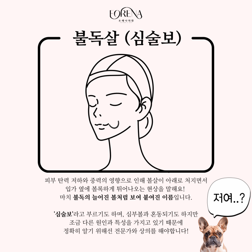 우리가 몰랐던 불독살에 관한 정보들과 이야기들을 알아보자 👀 관련 이미지 3