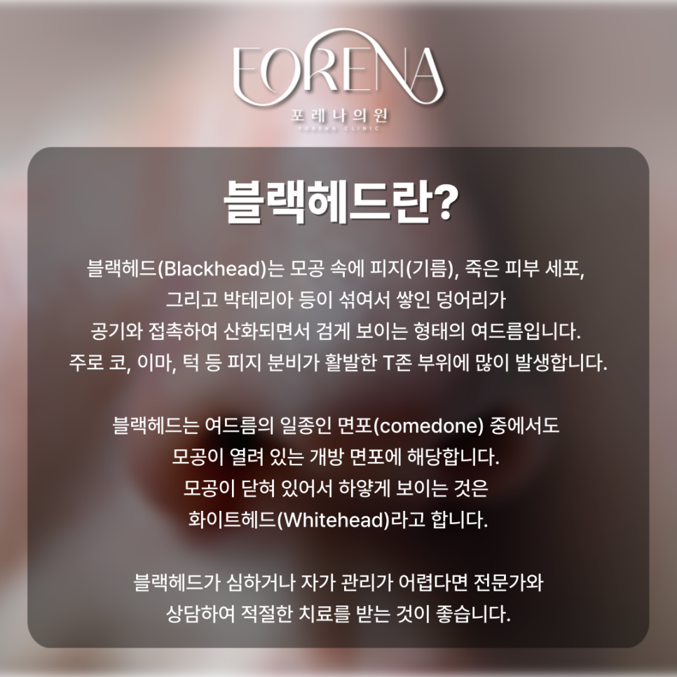 블랙헤드란 무엇인가? 홍대 포레나의원에서 알려드립니다!🤦🏼 관련 이미지 3