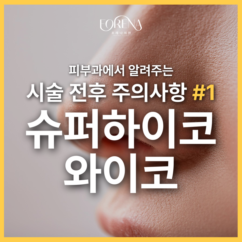 슈퍼하이코 와이코를 고민중이라면 미리 알아두어야 할 주의사항🚨 관련 이미지 2