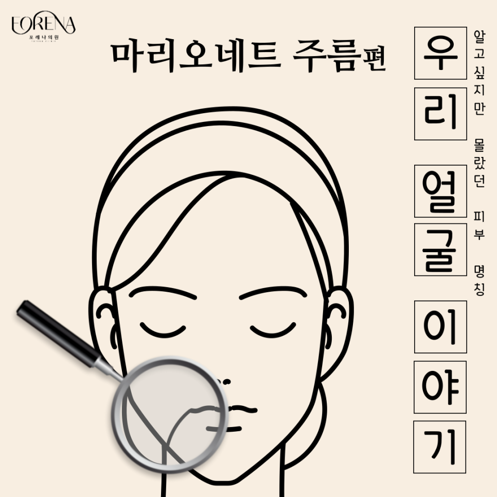 마리오네트 주름을 모르는 분들에게 포레나의원이 설명 드립니다! 👀 관련 이미지 2