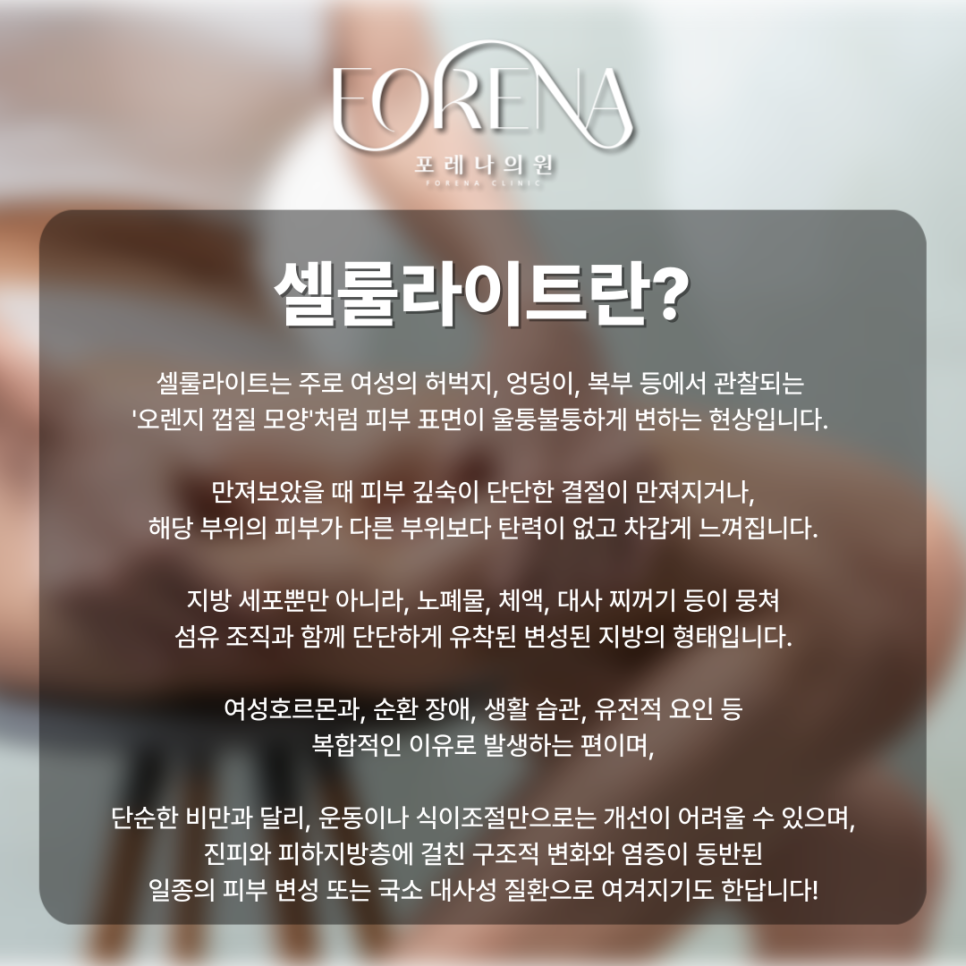 살빼고나서 셀룰라이트가 더 잘 보이는 것 같다면? 관련 이미지 3