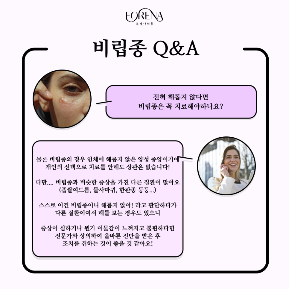 비립종에 대해 하나부터 열까지 알아보자! 👀 관련 이미지 6