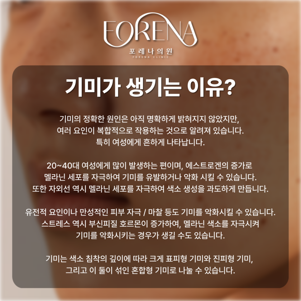 표피형, 진피형, 혼합형, 난치성 기미 고민 나한테 있는 기미는 어떤 종류일까?💧 관련 이미지 4