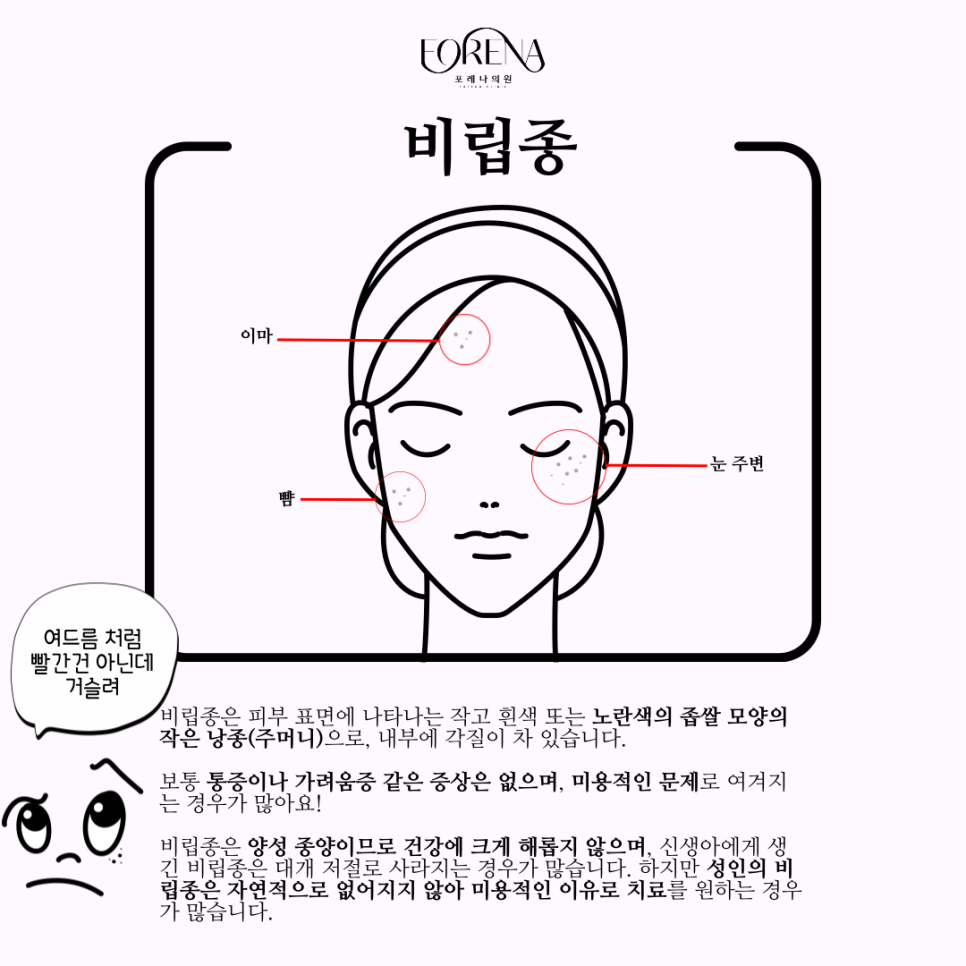 비립종에 대해 하나부터 열까지 알아보자! 👀 관련 이미지 3