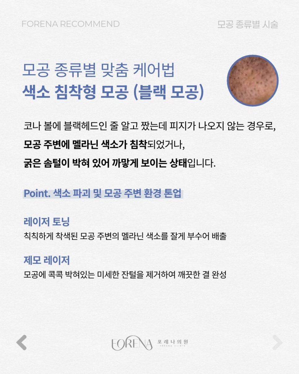 모공 유형별 관련 이미지 5
