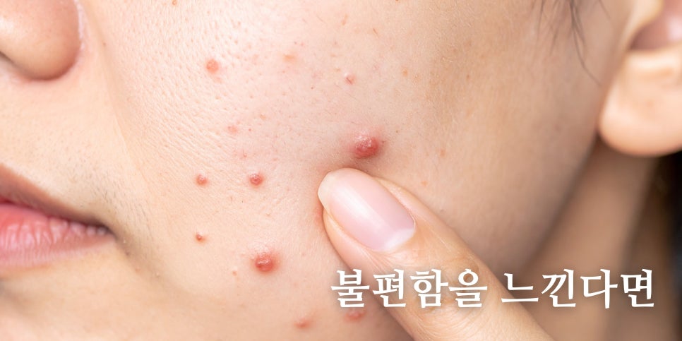 20대 초반 피부과 권장 시술? 아니 굳이 필요해?🤔  홍대 포레나의원 영상으로 같이보자! 관련 이미지 3