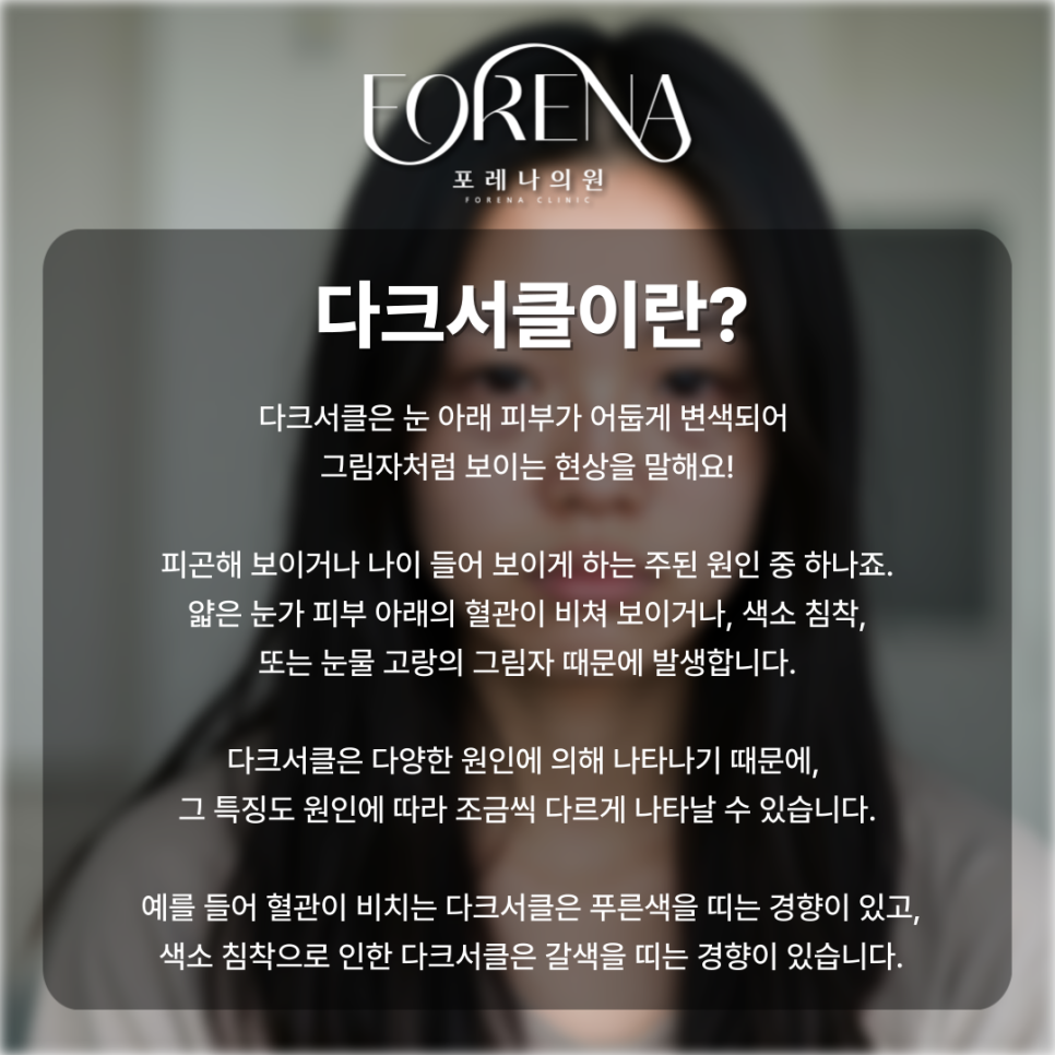 나... 안피곤한데?🐼 다크서클에 대한 모든 것을 알아보자!🥹 관련 이미지 3