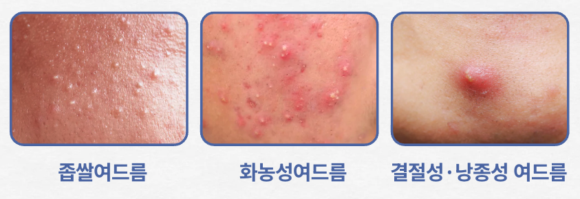 좁쌀인줄 알았는데 관련 이미지 8