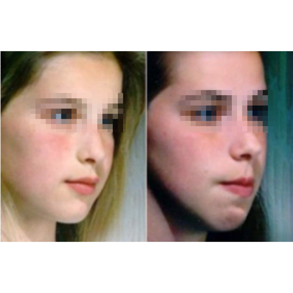 놓치기 쉬운 피부 꿀팁 7가지 여러분은 알고 계신가요?🪞 홍대 포레나의원 영상으로 같이보자! 관련 이미지 2