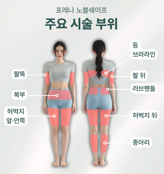 노블쉐이프 Q&A | 시술 원리와 특징 정리 관련 이미지 9