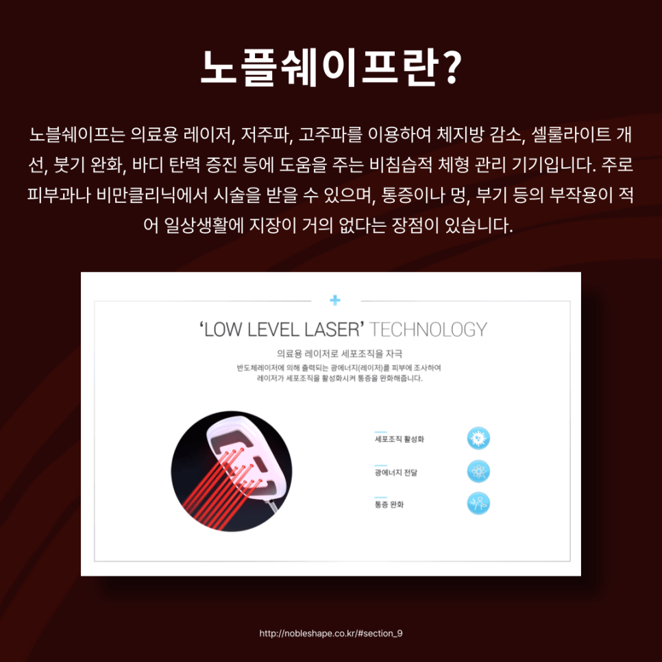 체형 관리 기기 노플쉐이프를 알아보자 🔎 관련 이미지 4