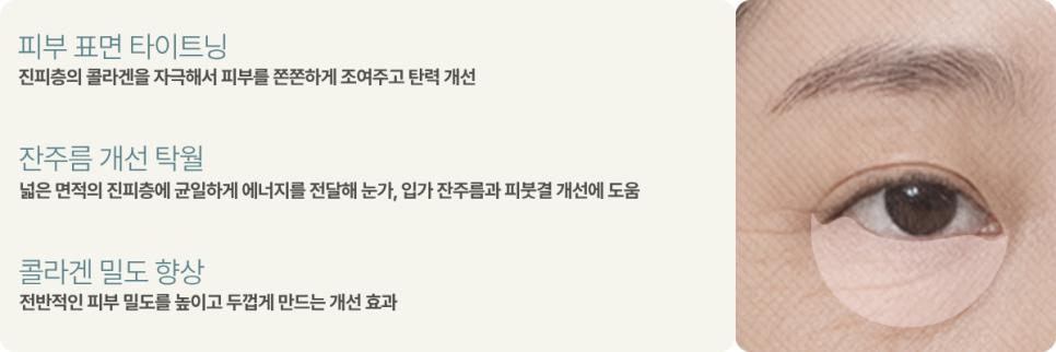 울쎄라피 vs 써마지 FLX 비교 분석! 관련 이미지 8