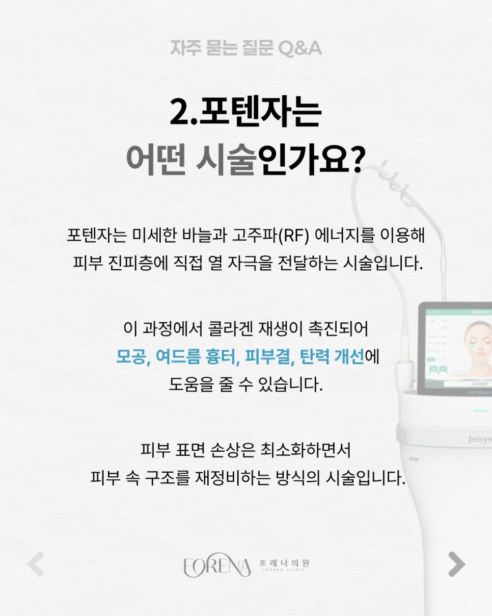 포텐자 Q&A | 시술 원리와 특징 정리 관련 이미지 3