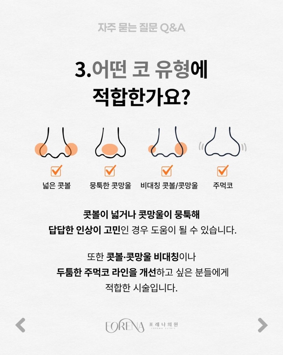 Nose-Sculpting Injection Q&A | An Overview of the Procedure’s Principles and Features image 4