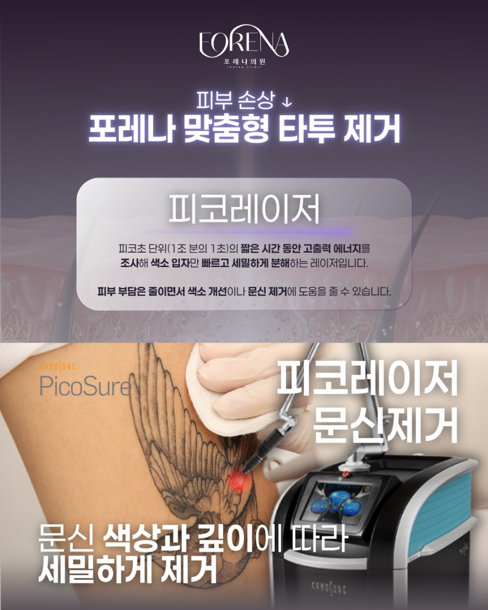 피코레이저 문신제거 포레나 당신의 고민은 어떤것들이 있나요? 관련 이미지 3