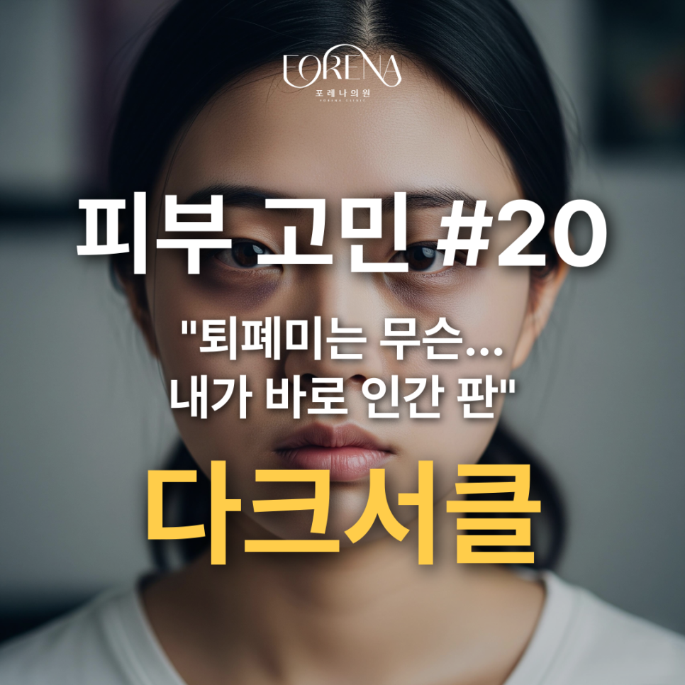 나... 안피곤한데?🐼 다크서클에 대한 모든 것을 알아보자!🥹 관련 이미지 2