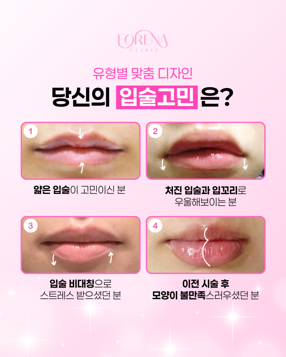 홍대피부과 입술필러, 아직도 용량만 고민하시나요? 관련 이미지 4