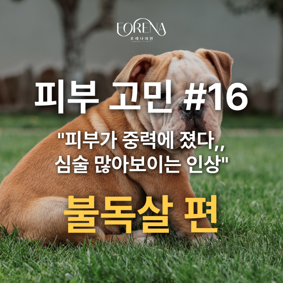 불독살 때문에 스트레스를 받는 분들을 위하여!🙍 관련 이미지 2