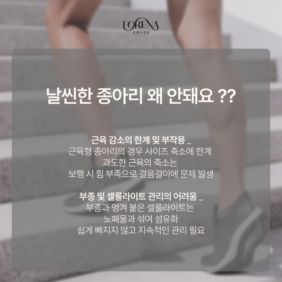종아리는 정말 신의 영역?? 관련 이미지 8
