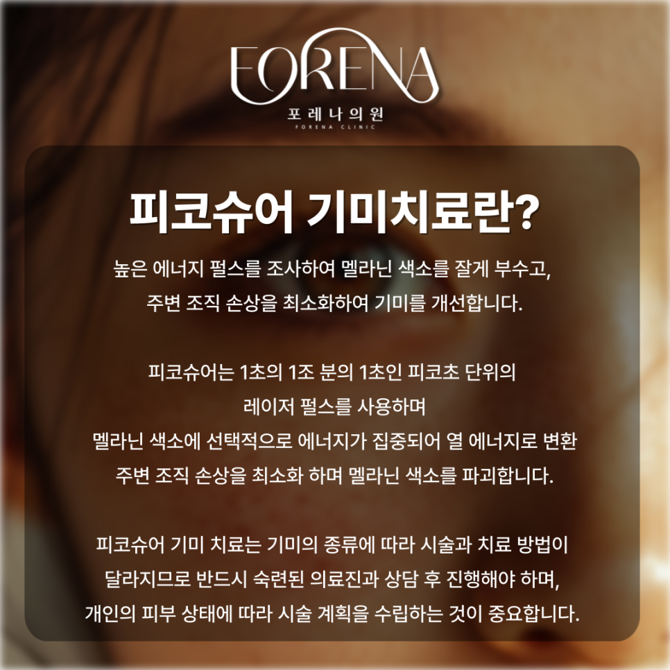 기미치료를 피코슈어 레이저치료로 결정했다면 보기 좋은 주의사항🚨 관련 이미지 3