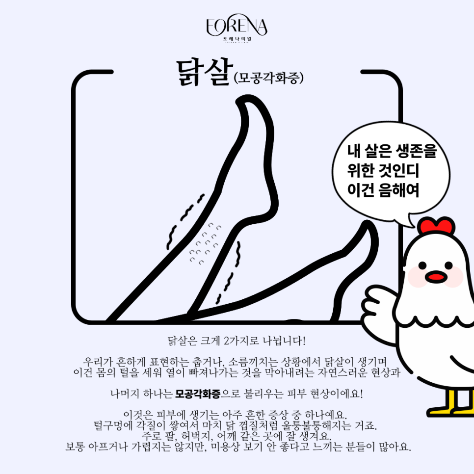 모공각화증이랑 닭살 돋는다 할때 닭살은 같은건가요?🐔 관련 이미지 3