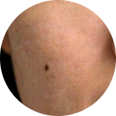 What Makes the Face Look Dull image 3