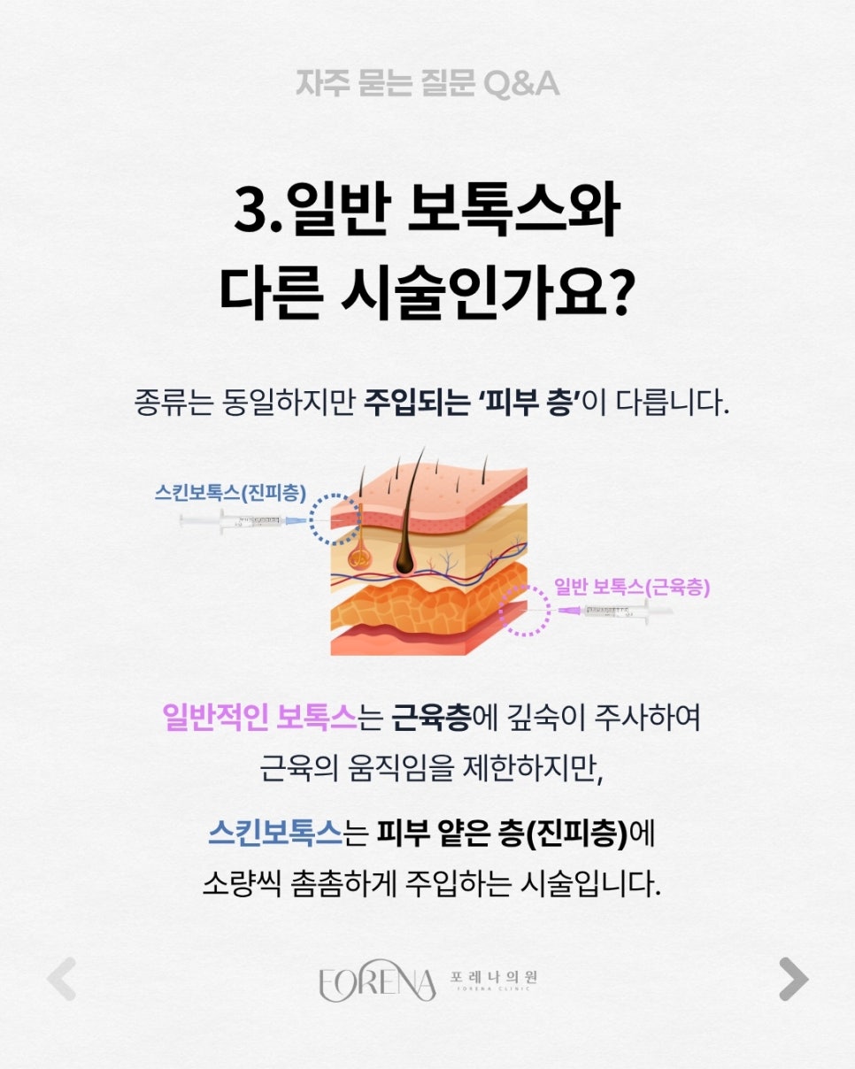 Skin Botox Q&A | A Guide to Its Principles and Features image 4