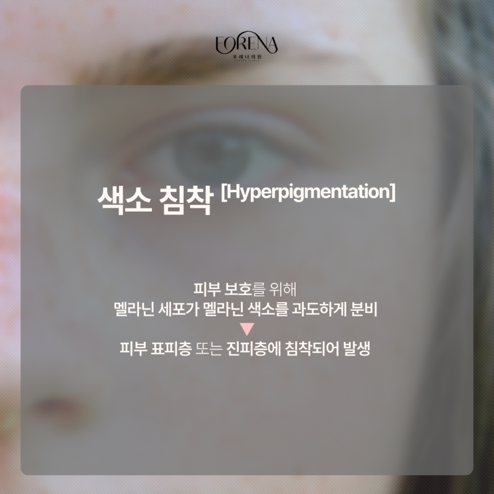 I Want to Brighten My Dull Skin Tone~ image 3