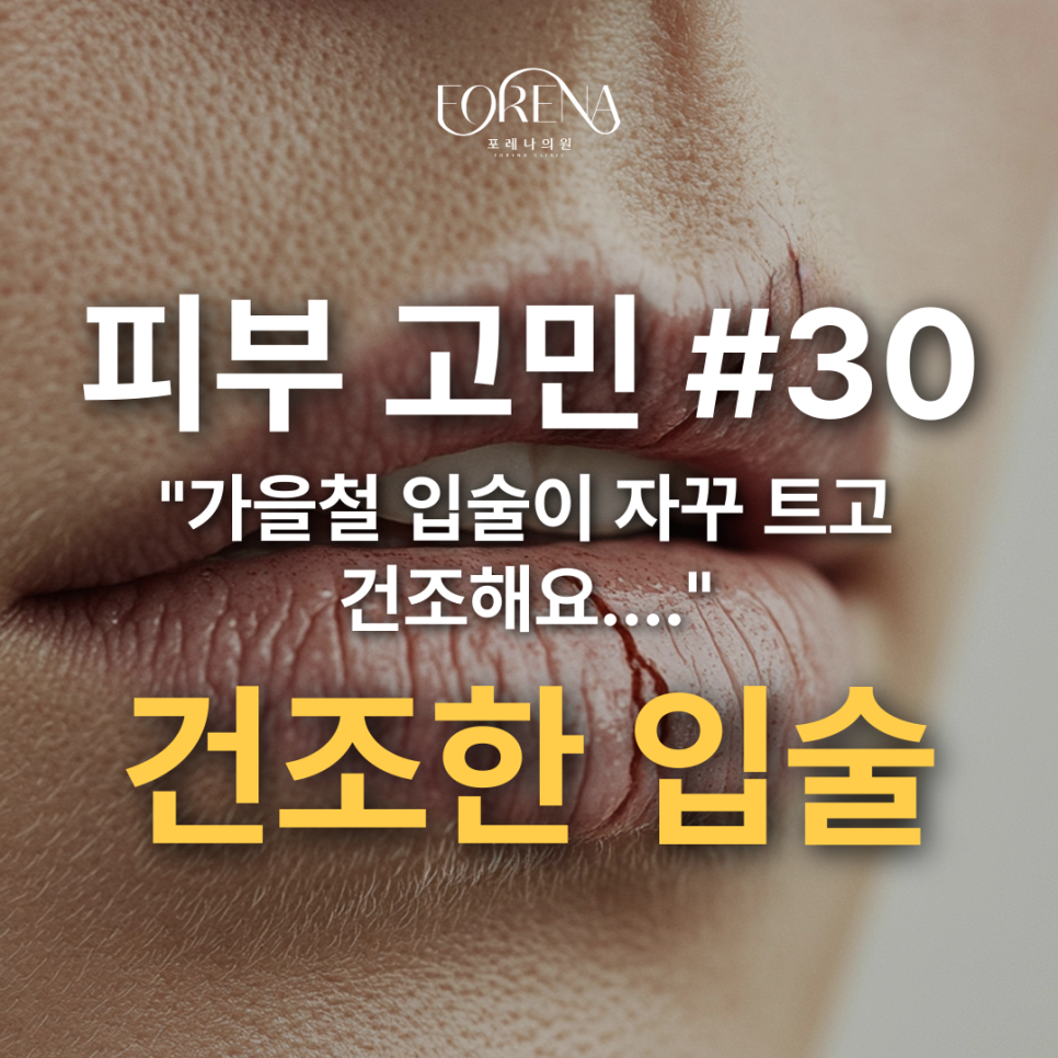 가을철 최대 고민 입술이 트고 건조하다면? 관련 이미지 2