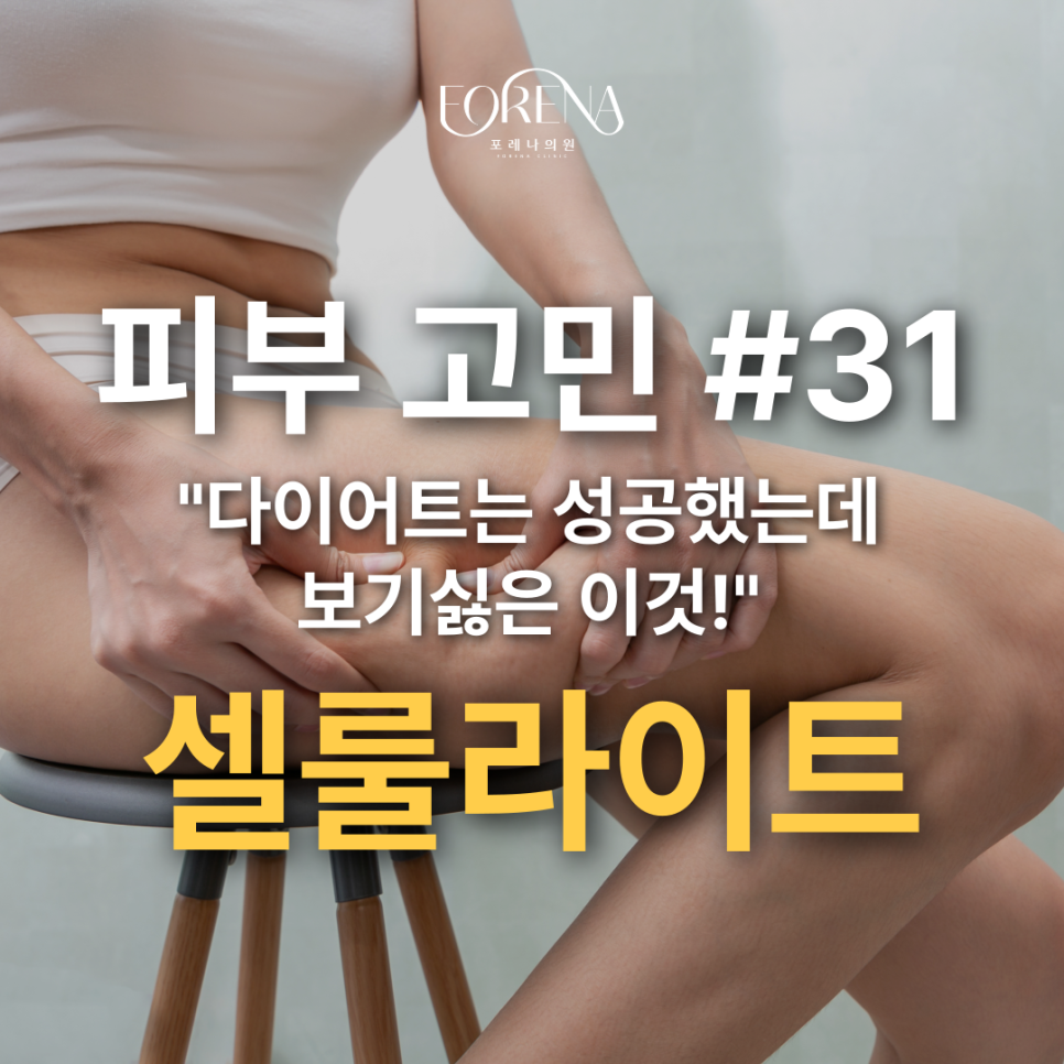 살빼고나서 셀룰라이트가 더 잘 보이는 것 같다면? 관련 이미지 2