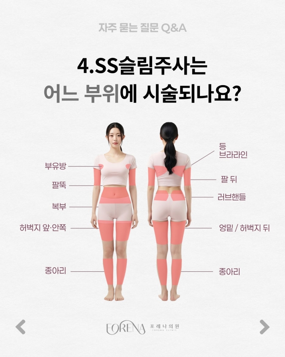 SS슬림주사 Q&A | 시술 원리와 특징 정리 관련 이미지 5