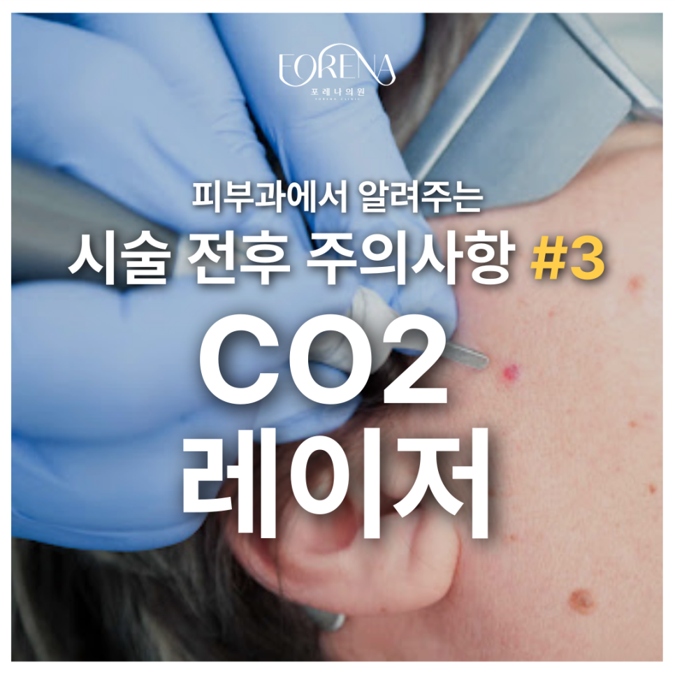 CO2 레이저를 고민중이라면 미리 봐야할 주의사항🚨 관련 이미지 2