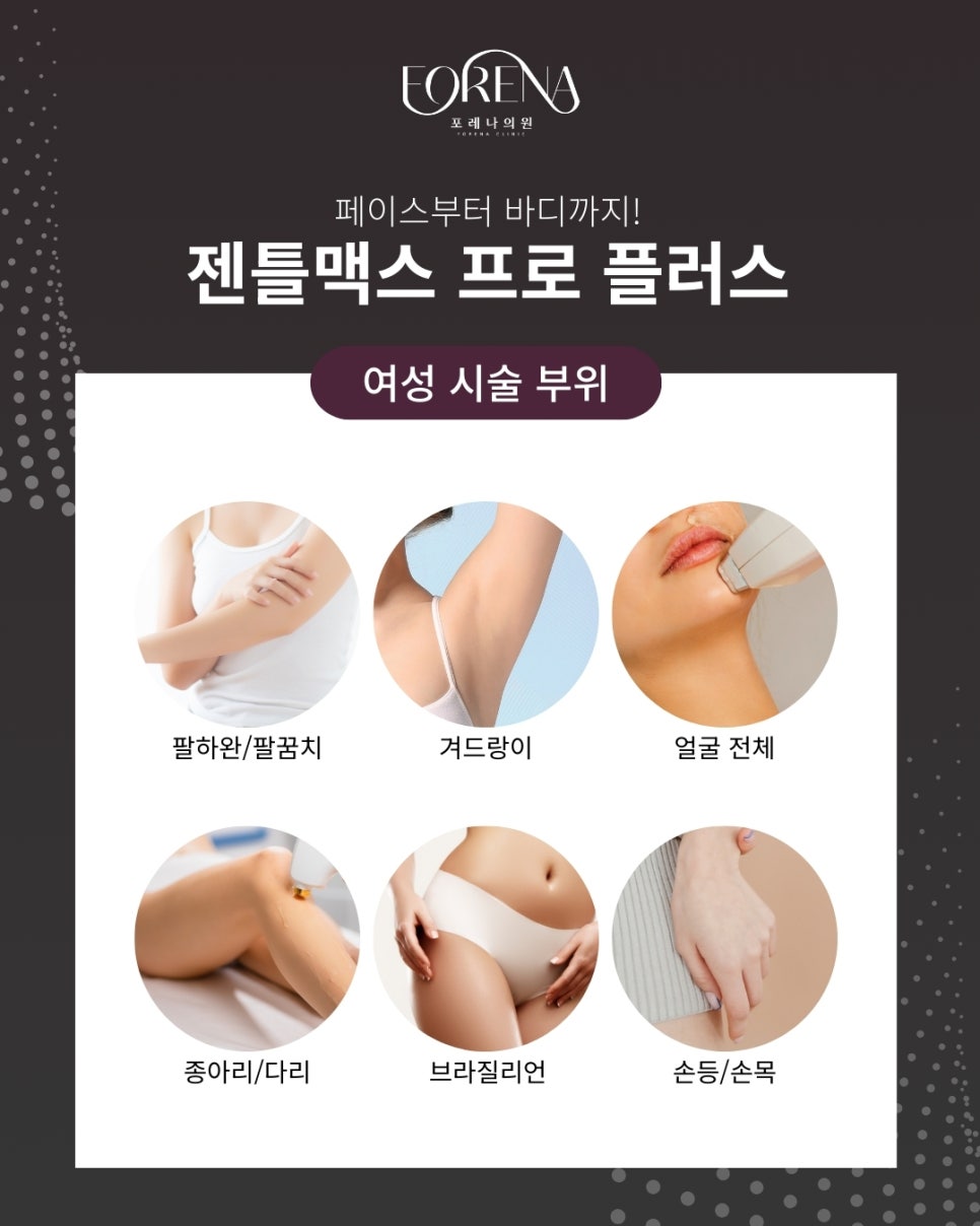 젠틀맥스프로 플러스 여성 제모는 무엇이 다른가요? 관련 이미지 4