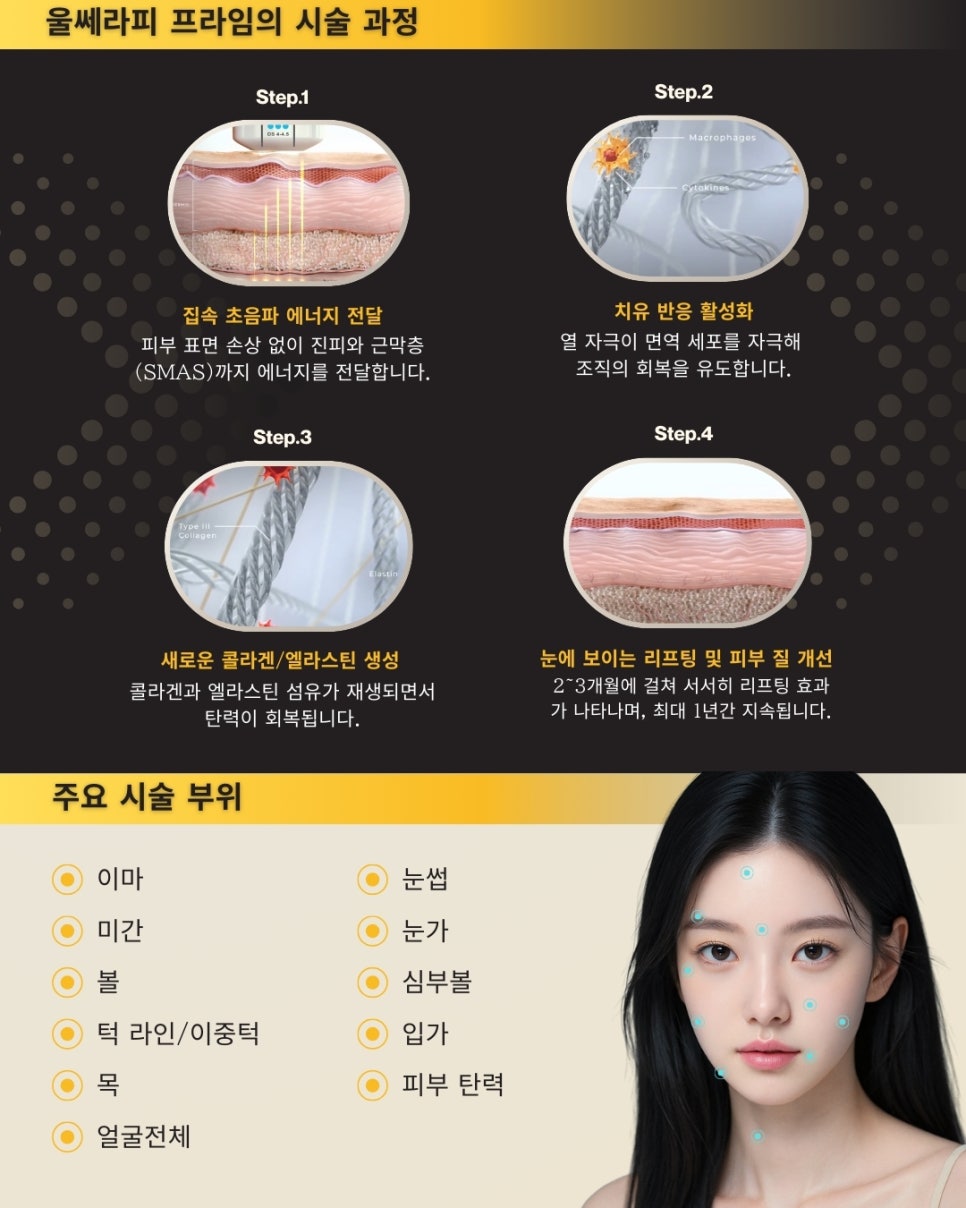 울쎄라피 프라임은 무엇이 다른가요? 관련 이미지 4