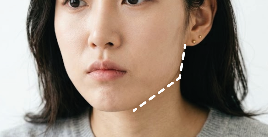 Square Jaw Botox Q&A | How the Procedure Works and Its Features image 8