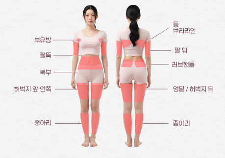 SS슬림주사 Q&A | 시술 원리와 특징 정리 관련 이미지 9